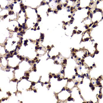 Immunohistochemistry - SF1 Antibody (144-06424)