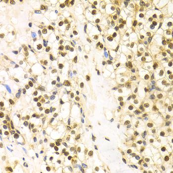 Immunohistochemistry - BAG1 Antibody (144-01104)