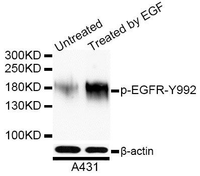 Western blot - Phospho-EGFR-Y992 antibody (144-50026)