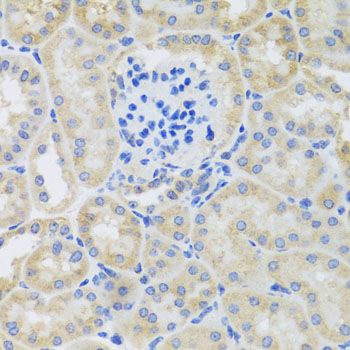Immunohistochemistry - BNIP3 Polyclonal Antibody (144-05683)