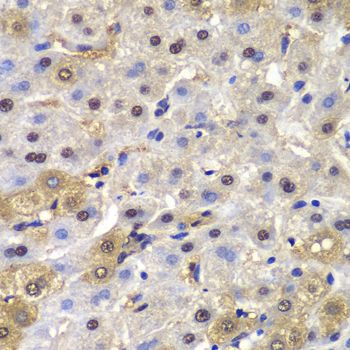 Immunohistochemistry - MAD1L1 antibody (144-01153)