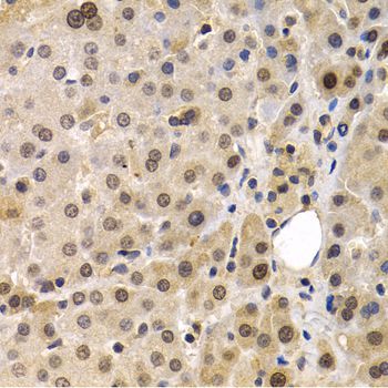 Immunohistochemistry - MAGEA1 antibody (144-05470)