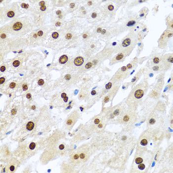 Immunohistochemistry - METTL3 Polyclonal Antibody (144-08370)