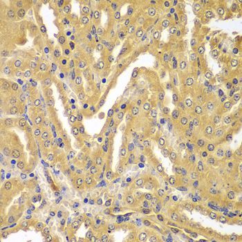 Immunohistochemistry - UBE2Z Polyclonal Antibody (144-07225)