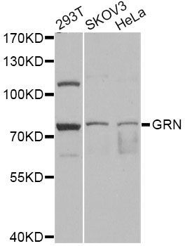 Western blot - GRN antibody (144-012440)