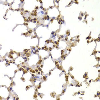 Immunohistochemistry - [KO Validated] S100A4 Polyclonal Antibody (144-01631)
