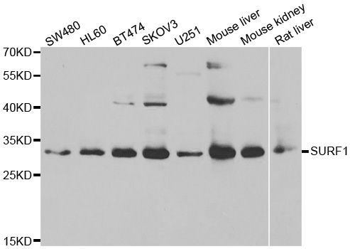Western blot - SURF1 antibody (144-06758)