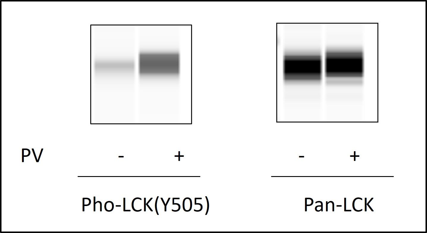 LCK (Y505) - Western Blot Analysis