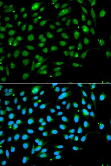 Immunofluorescence - ING3 antibody (144-05832)