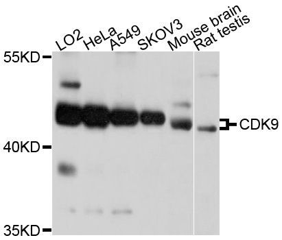 Western blot - CDK9 Polyclonal Antibody (144-60040)