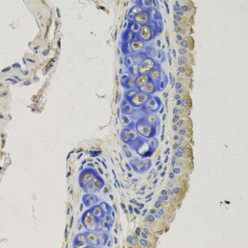 Immunohistochemistry - GPHN Polyclonal Antibody (144-08572)