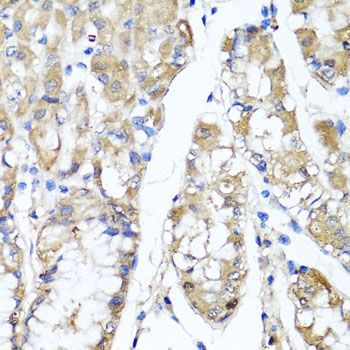 Immunohistochemistry - TNFAIP6 antibody (144-06419)