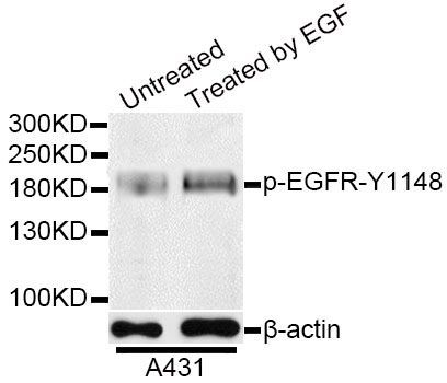Western blot - Phospho-EGFR-Y1148 antibody (144-50028)