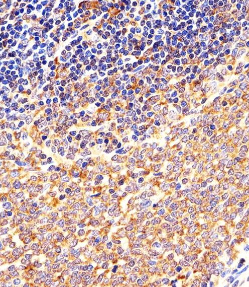 IHC-P