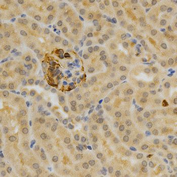 Immunohistochemistry - TNFRSF11B Polyclonal Antibody (144-02100)