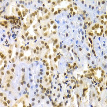 Immunohistochemistry - MAPK3 Polyclonal Antibody (144-00228)