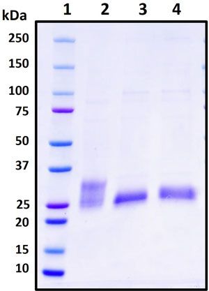 SDS-PAGE