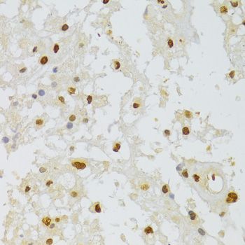 Immunohistochemistry - HNRNPA1 Polyclonal Antibody (144-07491)