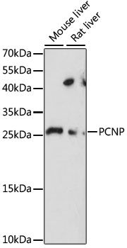 Western blot - PCNP antibody (144-015482)