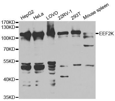 Western blot - [KO Validated] EEF2K Polyclonal Antibody (144-05404)