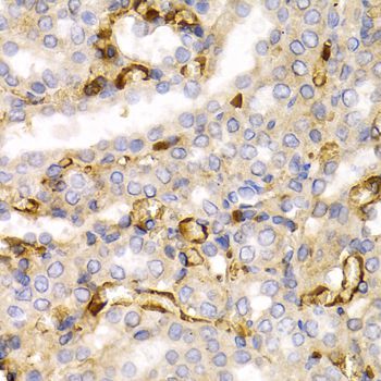 Immunohistochemistry - NEFL Polyclonal Antibody (144-00257)