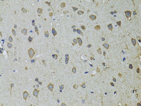 Immunohistochemistry - UGDH antibody (144-01210)