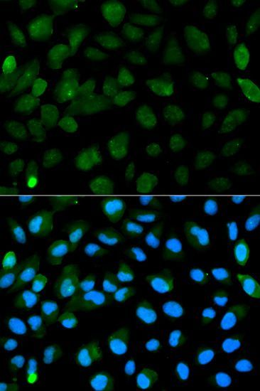 Immunohistochemistry - [KO Validated] PML Polyclonal Antibody (144-01184)