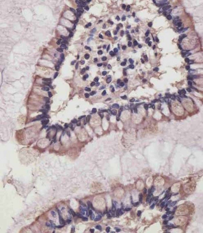 IHC-P