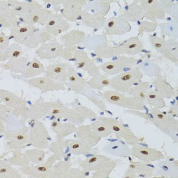 Immunohistochemistry - DDB1 Polyclonal Antibody (144-02896)