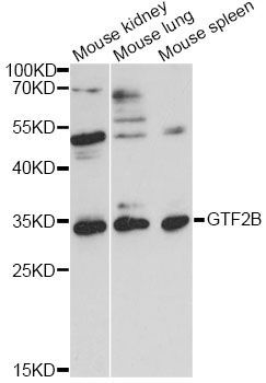 Western blot - GTF2B antibody (144-61315)