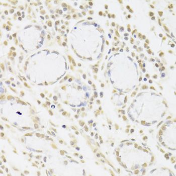 Immunohistochemistry - SNRPA Antibody (144-06410)