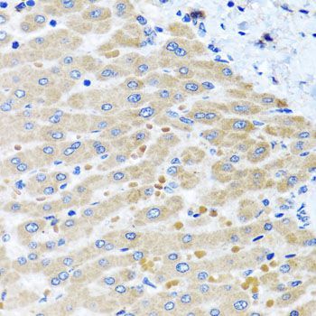 Immunohistochemistry - DARS2 antibody (144-07813)
