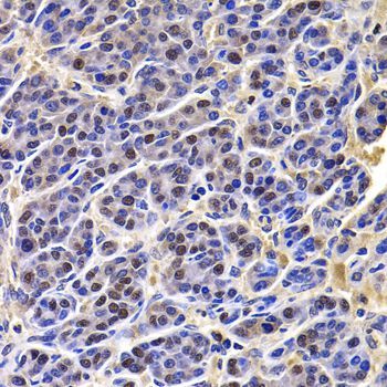 Immunohistochemistry - HIRIP3 antibody (144-07014)