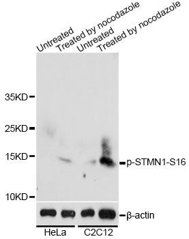 Western blot - Phospho-STMN1-S16 antibody (144-50229)