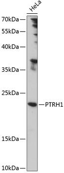 Western blot