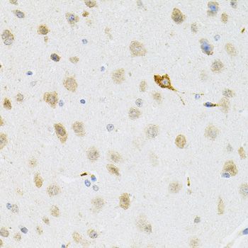 Immunohistochemistry - SYK Antibody (144-02123)