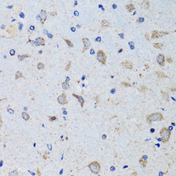 Immunohistochemistry - [KO Validated] PTPN1 Polyclonal Antibody (144-01590)