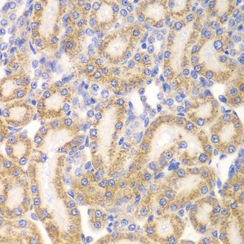 Immunohistochemistry - EYA3 Polyclonal Antibody (144-07893)