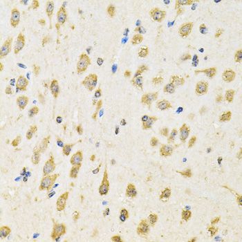 Immunohistochemistry - PTPRE antibody (144-07209)