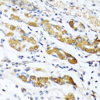 Immunohistochemistry - OGN antibody (144-06679)