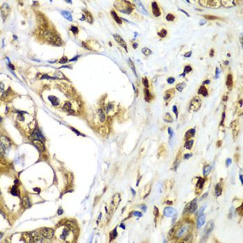 Immunohistochemistry - TMOD4 antibody (144-06772)