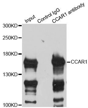 Immunoprecipitation - 3ug CCAR1 antibody (144-013595)