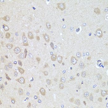 Immunohistochemistry - PDK3 antibody (144-08028)