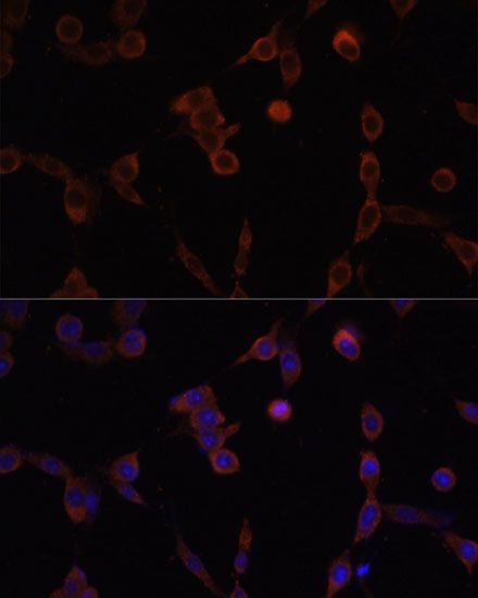 Immunofluorescence - LAMP1 Polyclonal Antibody (144-02582)