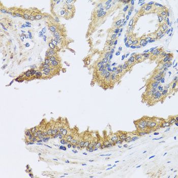 Immunohistochemistry - ARL6 antibody (144-08269)