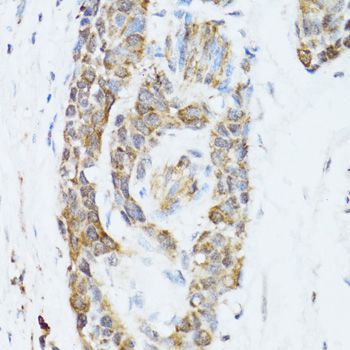 Immunohistochemistry - TOLLIP antibody (144-02202)