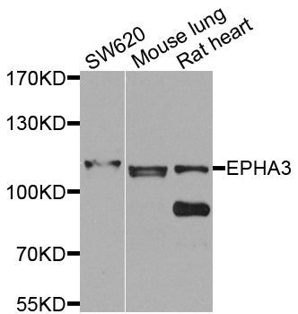 Western blot - EPHA3 antibody (144-08414)