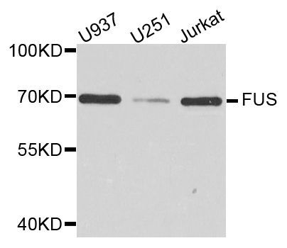 Western blot - [KO Validated] FUS Polyclonal Antibody (144-05921)