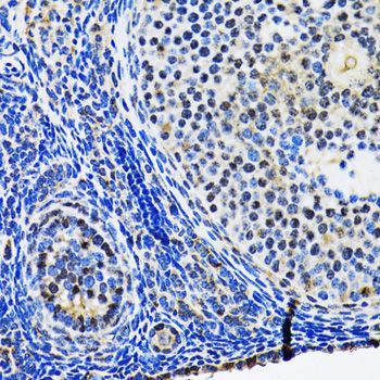 Immunohistochemistry - TP53 Polyclonal Antibody (144-05761)