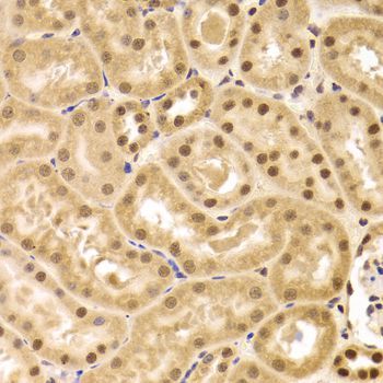 Immunohistochemistry - ANP32A Antibody (144-05768)